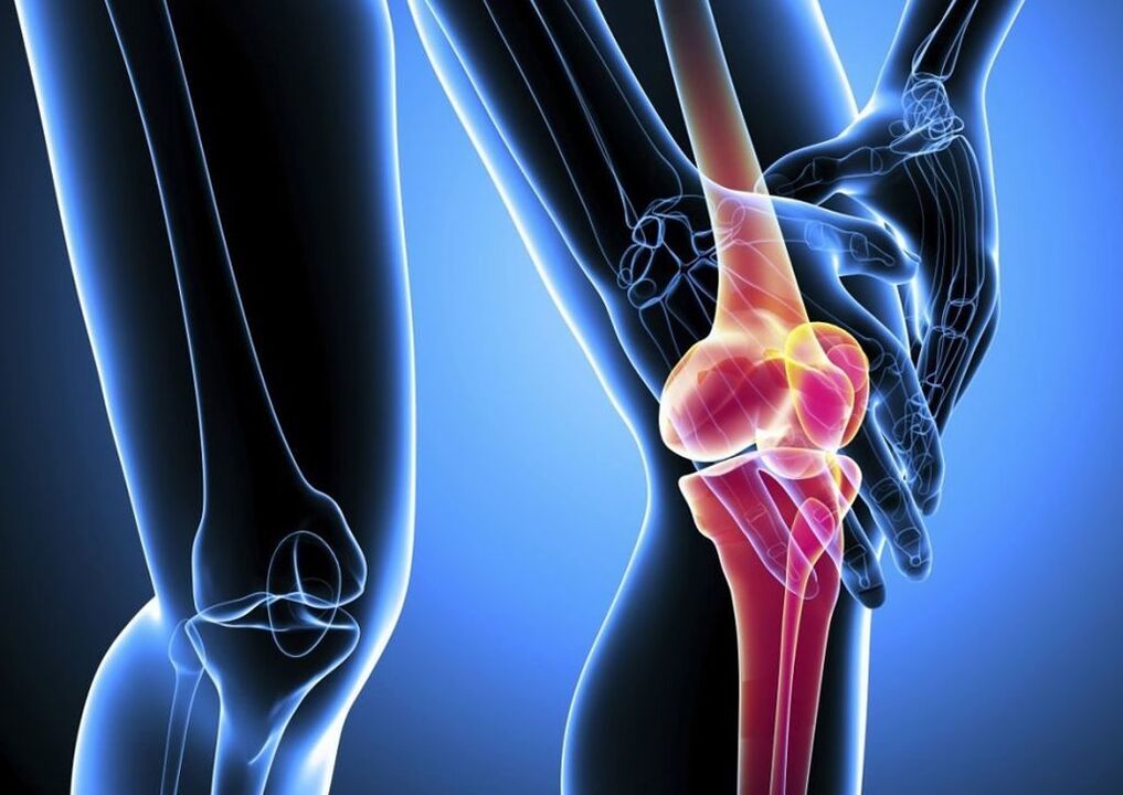 Pain during physical activity in osteoarthritis of the knee