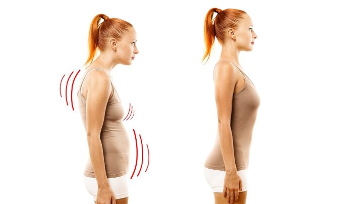 stopping as the cause of the development of lumbar osteochondrosis