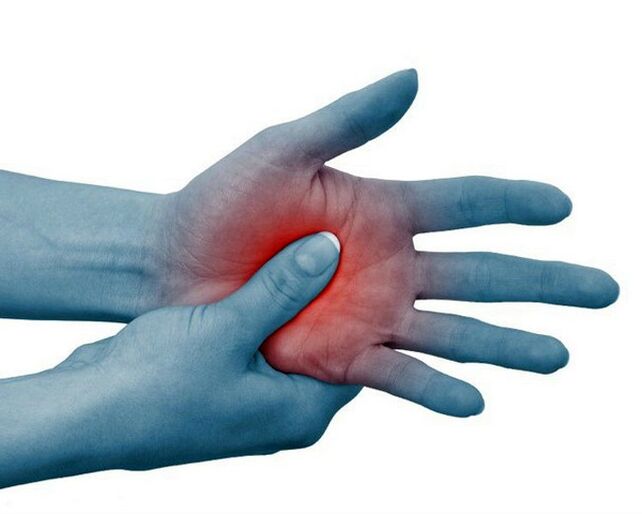 Severe pain in the joints of the fingers, which decreases with physical exercise, is a typical sign of rheumatoid arthritis.