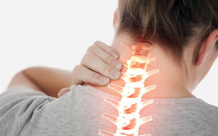 Cervical osteochondrosis
